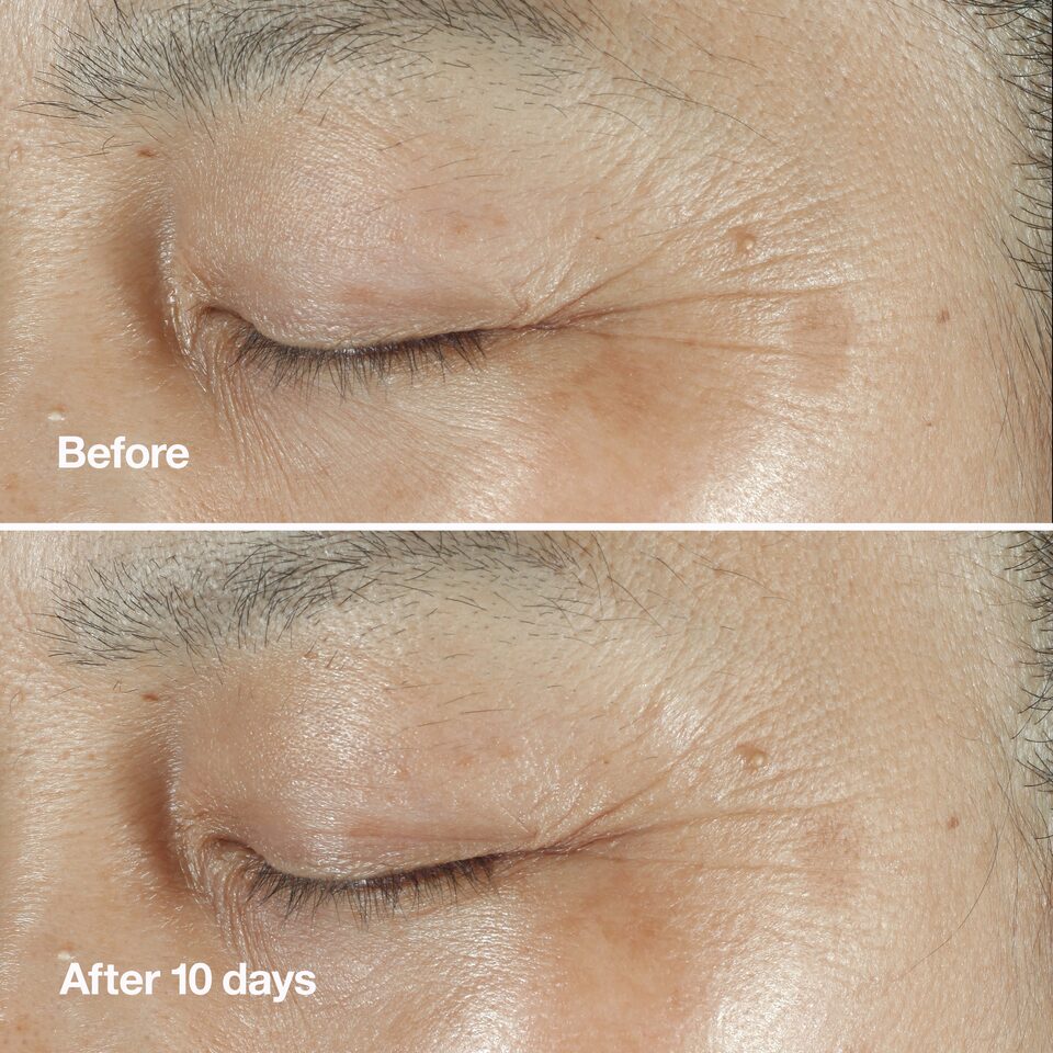 Clinique Smart Clinical Repair™ Wrinkle Correcting Serum | Takashimaya
